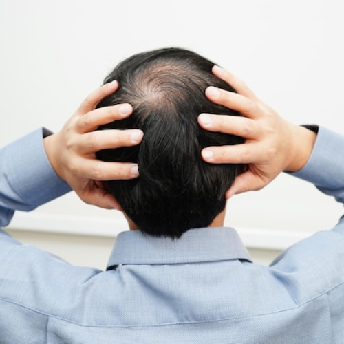 Reduces hair fall
